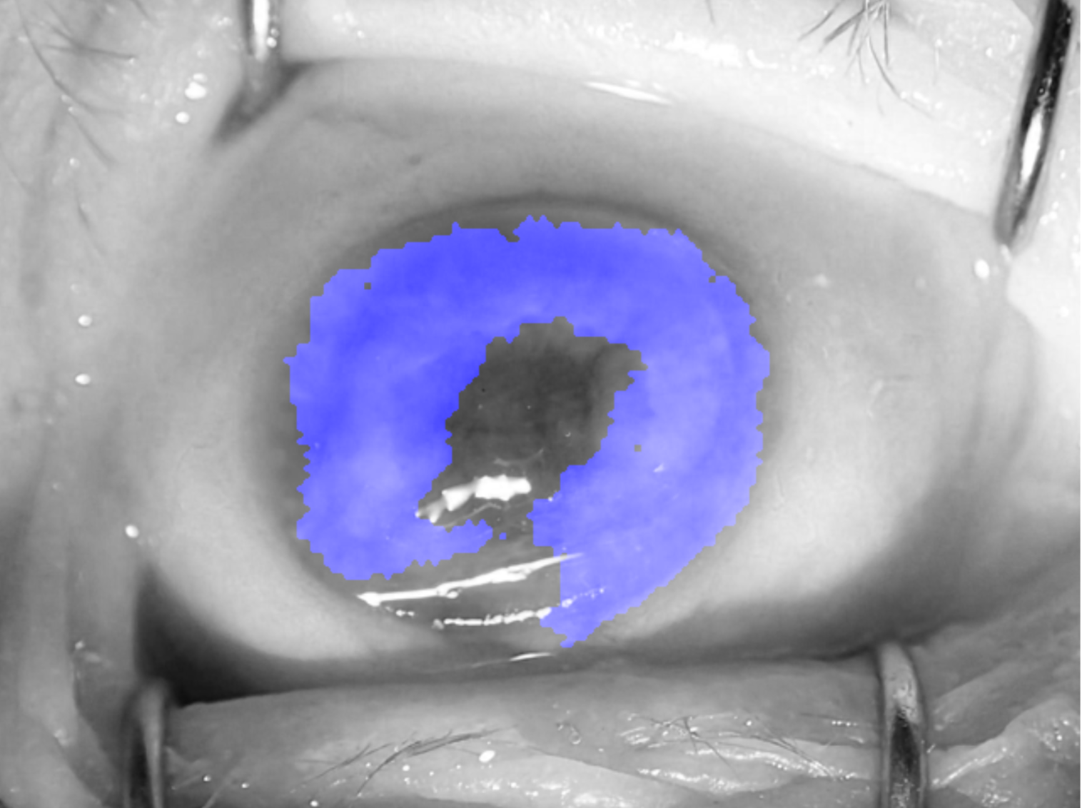 170000-iris-image-segmentation-under-troublesome-conditions